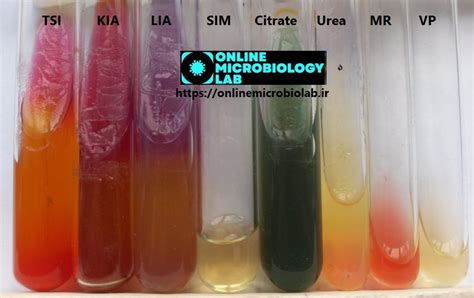 shigella sonnei biochemical tests|BAM Chapter 6: Shigella .